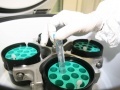 News: Scoperta la proteina HINT1: una nuova arma contro il melanoma?  - Lo studio condotto dall'Istituto di patologia generale dell'Universita' Cattolica di Roma in collaborazione con Columbia University di New York e Harvard University di Boston