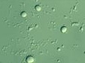 chimica: Sequenziato il Dna del 'batterio mangiapetrolio' -   Si chiama Acinetobacter venetianus e fu isolato nel 1996 nella laguna veneta
